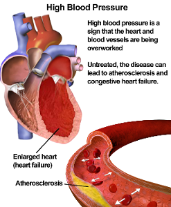 What is considered a healthy blood pressure reading?