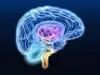 Braintec Braintec