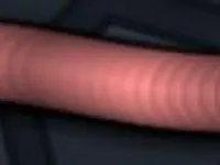 skin 19