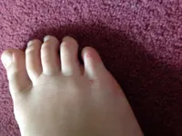 2 2