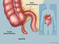 The appendix