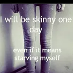 Do you have a eating disorder?