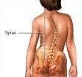 Living With Scoliosis Living With Scoliosis
