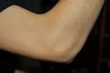 Is it possible to lick your elbow?!?!? i know it sounds like a silly question but i want to know if anyone has done it, cuz' i CAN NOT!!! Is it possible to lick your elbow?!?!? i know it sounds like a silly question but i want to know if anyone has done it, cuz' i CAN NOT!!!