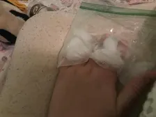 Hurts to bend my fingers
