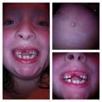 when will you lose your next tooth kids only? when will you lose your next tooth kids only?