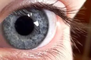 Capture Capture