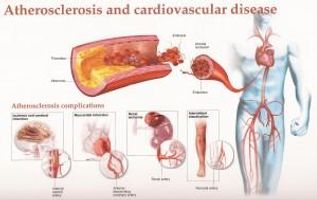 Easy Solutions To Prevent A Deficitary Blood Circulation | With Gloves Easy Solutions To Prevent A Deficitary Blood Circulation | With Gloves