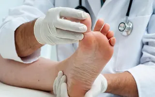 Diabetes Foot Ulcer Symptoms, Causes, Infections and Treatment Diabetes Foot Ulcer Symptoms, Causes, Infections and Treatment