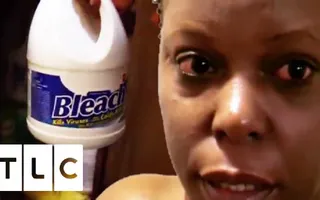 Addicted to Bathing In Bleach | My Strange Addiction Addicted to Bathing In Bleach | My Strange Addiction