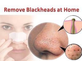 Blackheads Removing Mask Blackheads Removing Mask