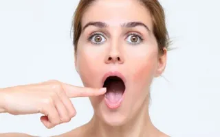 Canker sore on tongue - Articledefine Canker sore on tongue - Articledefine