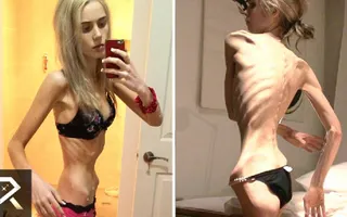 10 Teens You Won't Believe Exist pt.2