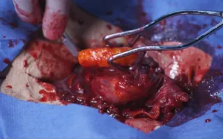 BANNED CHEETOS COMMERCIAL (VERY GRAPHIC) BANNED CHEETOS COMMERCIAL (VERY GRAPHIC)