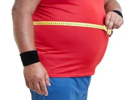 What do you think about obesity? What do you think about obesity?