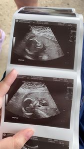 Meadow in Development...(My Pregnancy Journey)'s Photo