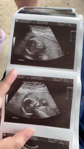 Meadow in Development...(My Pregnancy Journey)'s Photo