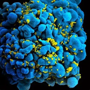 Hiv