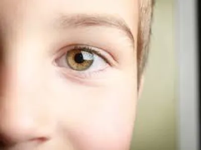 Hazel