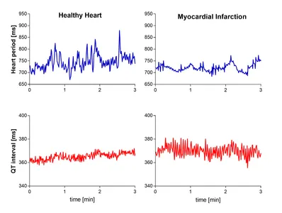 What is considered a healthy heart rate?
