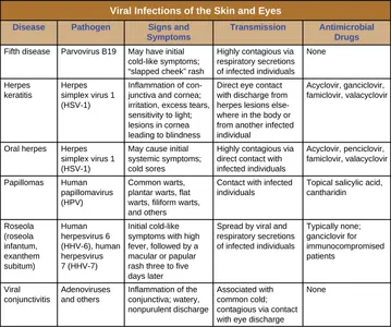 Which of the following is NOT a viral disease?