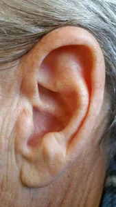 What do you call earrings that cover the entire earlobe?