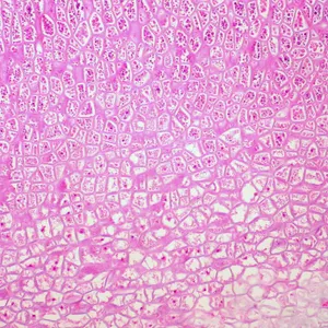 Which of the following is NOT a type of plant tissue?