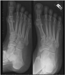 What projection is this xray?
