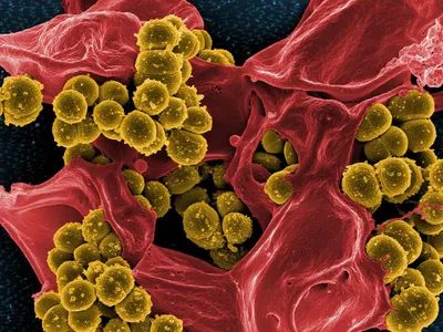 Which microscope is commonly used to study bacteria?