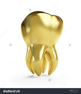 Gold teeth, Grey Goose, Trippin' in the bathroom Gold teeth, Grey Goose, Trippin' in the bathroom