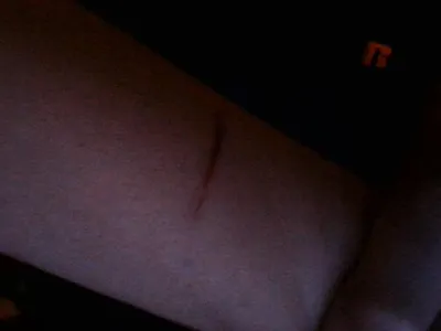 My Dog Did This To Me :(