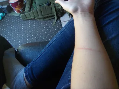 TW: scratches. Wrangled a chicken, and it hated my guts