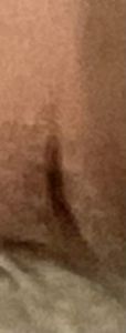 Guys help…what do I do 😭 it hurts