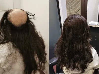 HairReplacementSG