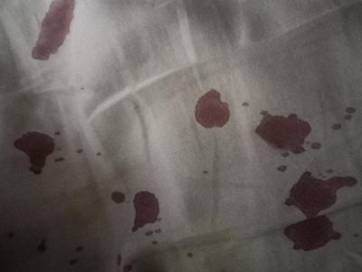What my nose caused last night at 2 in the morning