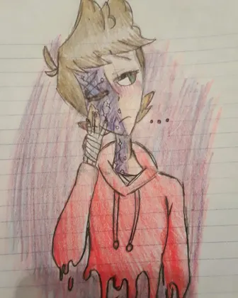 Pretty Scars??