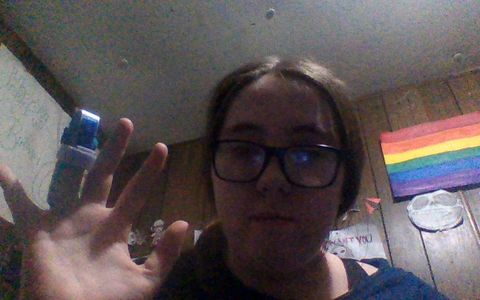 this is why u be carful with knifes this is why u be carful with knifes