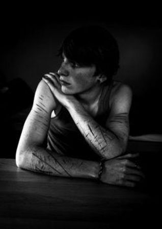 Have you ever self harmed?