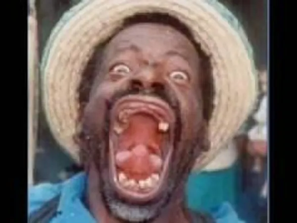 are u retard