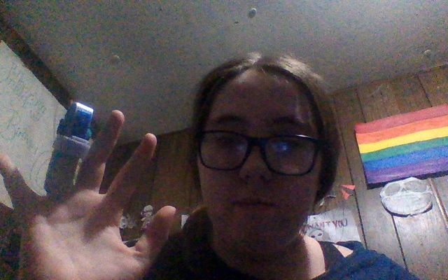 this is why u be carful with knifes this is why u be carful with knifes