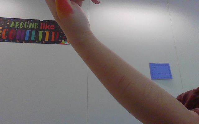 should i stop cutting myself should i stop cutting myself