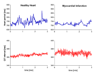 What is considered a healthy heart rate?