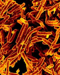 Which microorganism is responsible for causing tuberculosis?