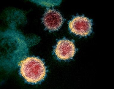 Which virus causes chickenpox?