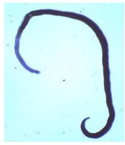 A imagem apresenta um Schistosoma Mansoni Bilharziosis Macho ou Fêmea?