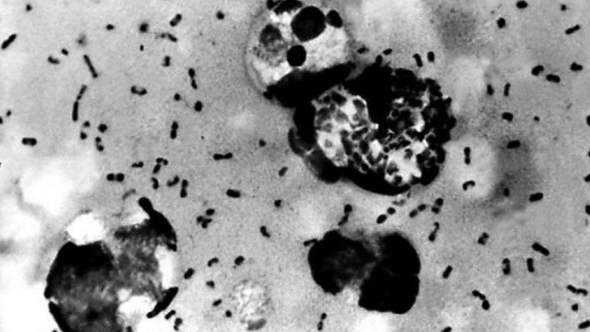 What is the name of the bacillus that made the Black Death spread?