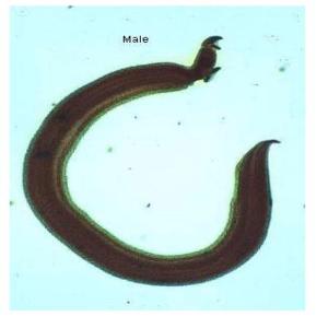 A imagem apresenta um Schistosoma Mansoni Bilharziosis Macho ou Fêmea?
