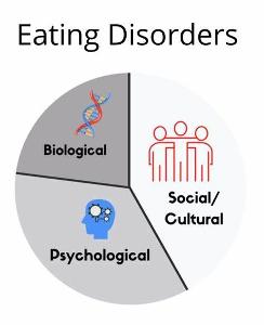 Which of the following is a common eating disorder?