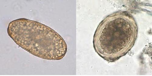 Diga qual o Ovo de Ascaris Lumbricoides Fertil e qual o Infertil?