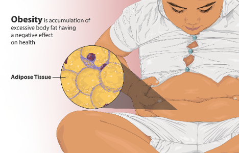 What is the term for excess fat accumulation in the abdominal area?